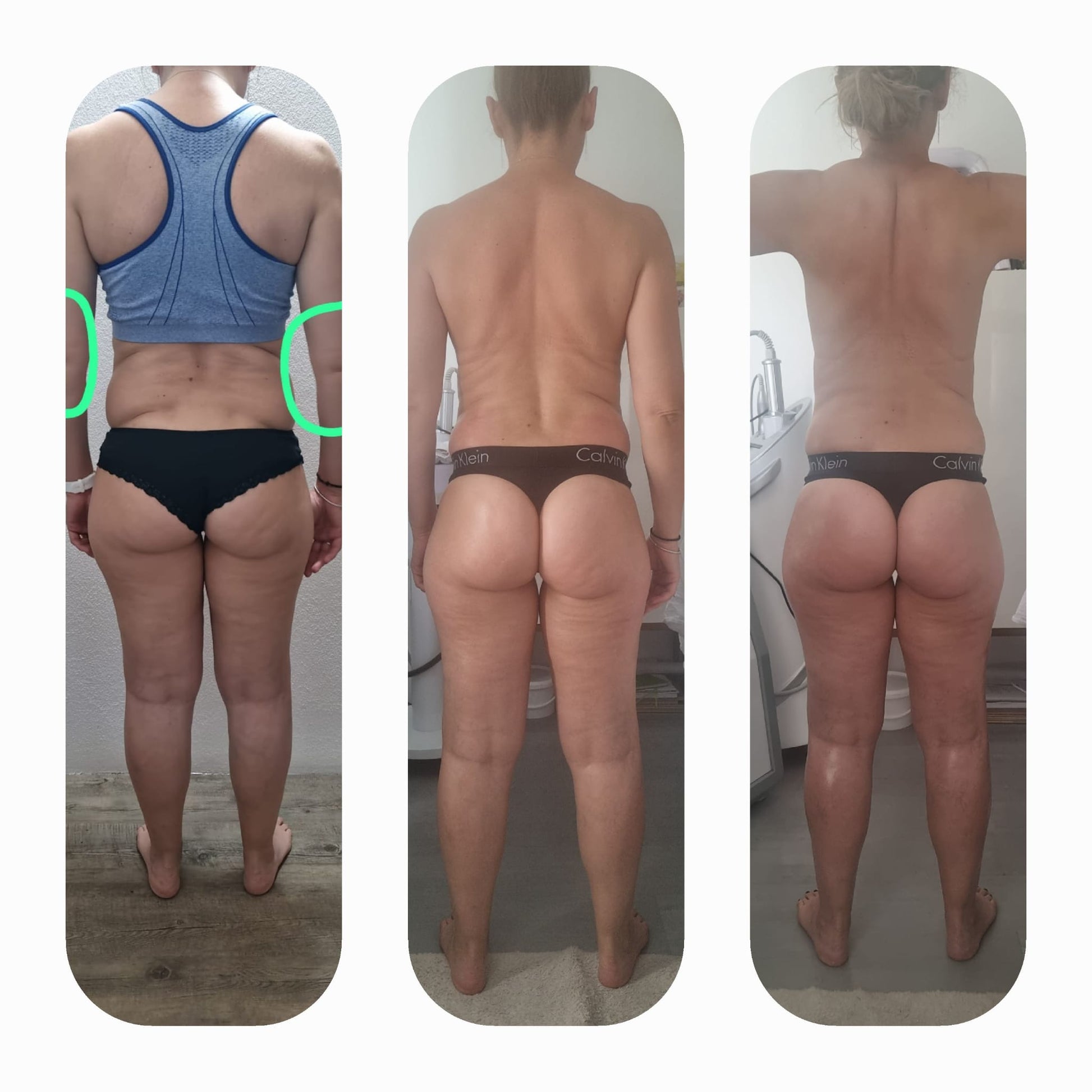 Program Detoxifiere NutriFit Up 45 de zile