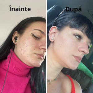 In Green, Mix Verde ECO 200g - Anti-Balonare, Detoxifiant, Pentru talie suplă, 40 porții